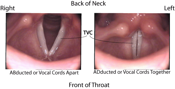 medspeechinc-VCD